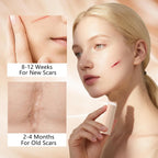 QuikRelief™ Silicone Scar Repair Stick