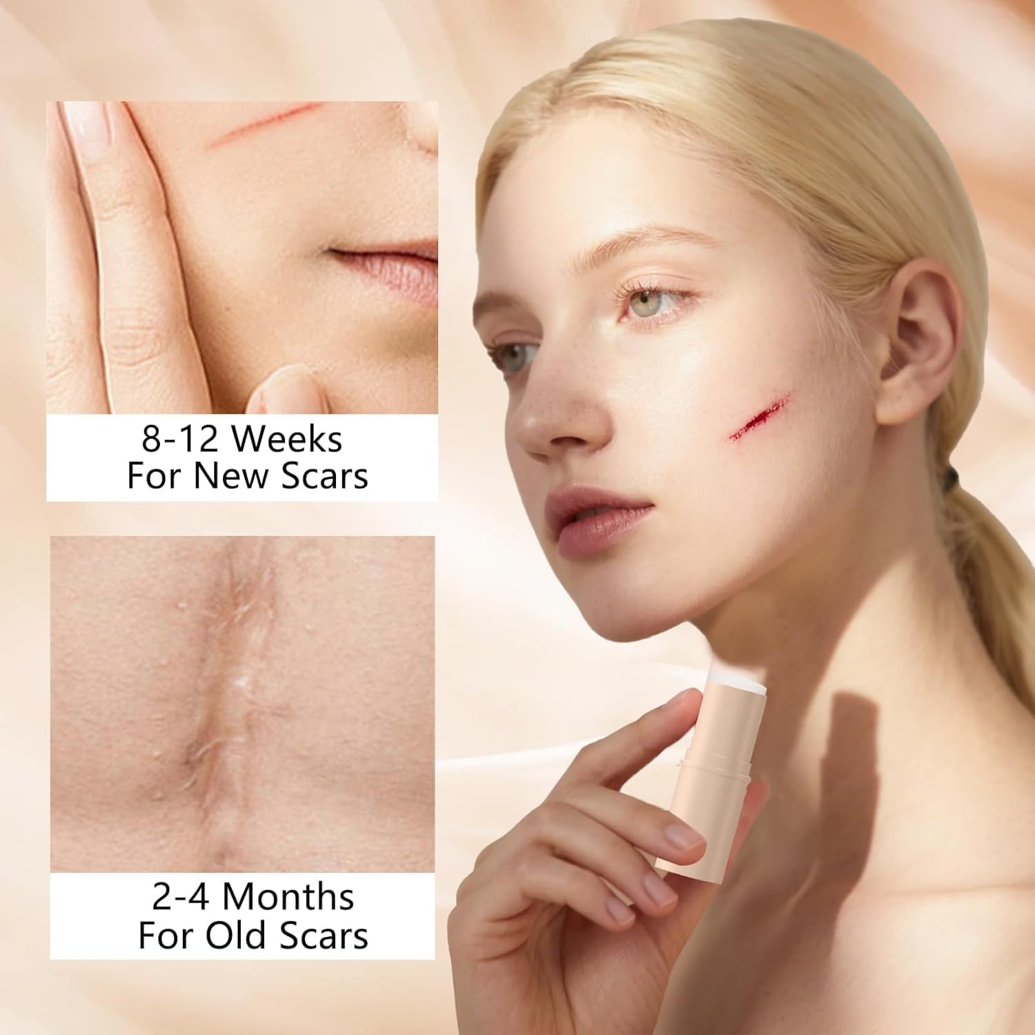 QuikRelief™ Silicone Scar Repair Stick