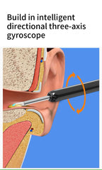 👂HD Wireless Ear Wax Removal Camera