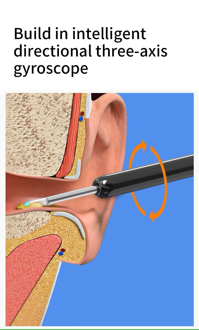 👂HD Wireless Ear Wax Removal Camera