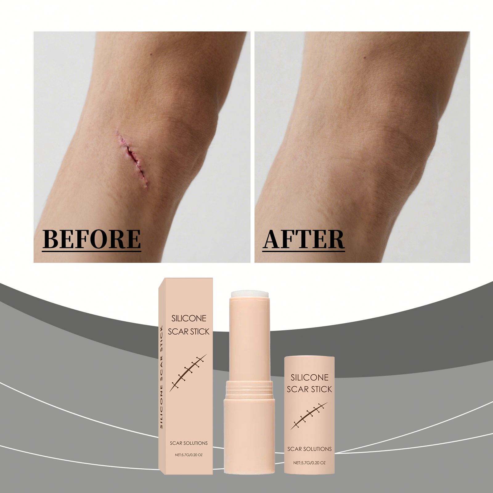 QuikRelief™ Silicone Scar Repair Stick