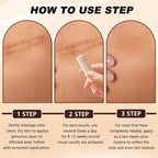QuikRelief™ Silicone Scar Repair Stick