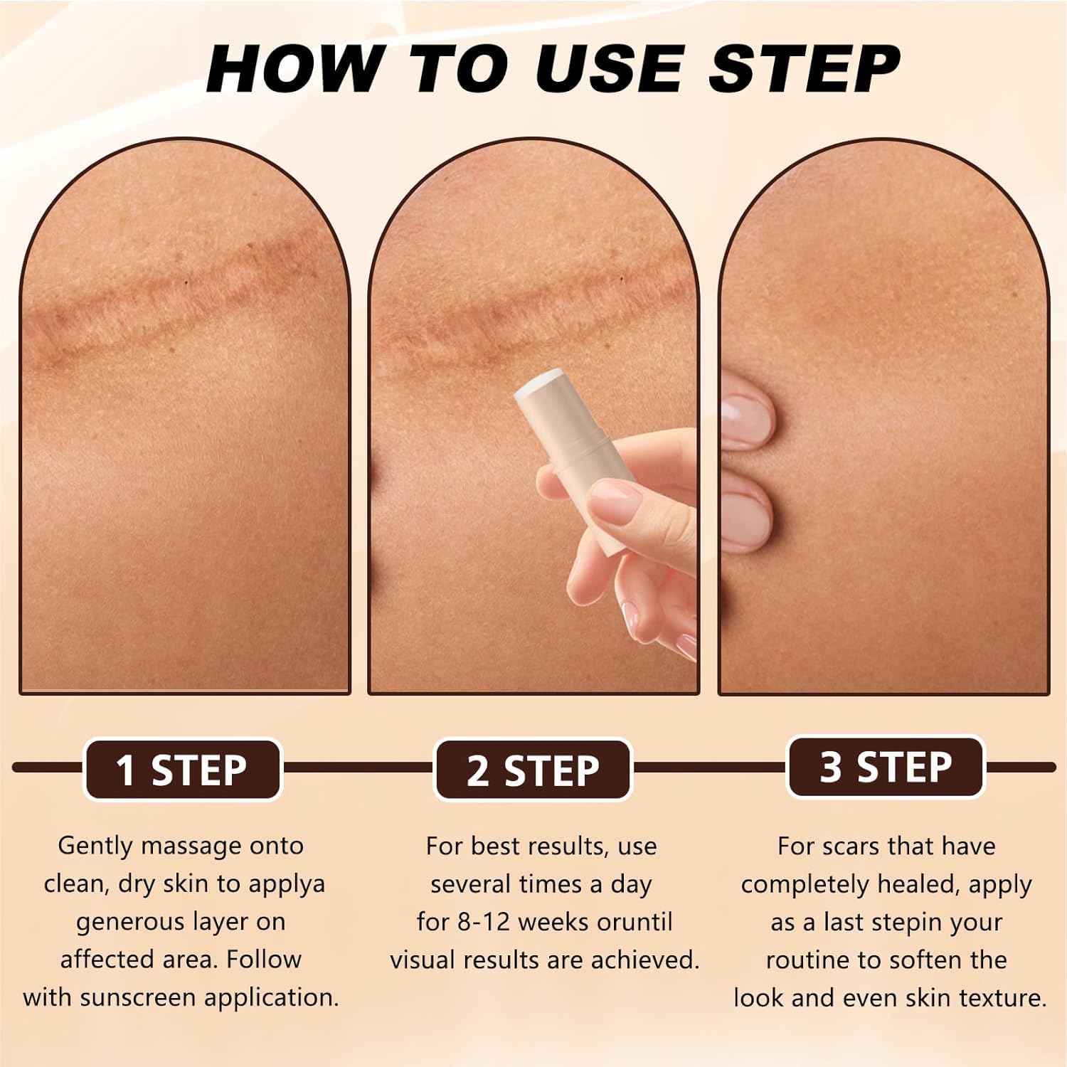 QuikRelief™ Silicone Scar Repair Stick